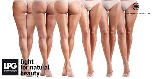 legs-lpg.jpg