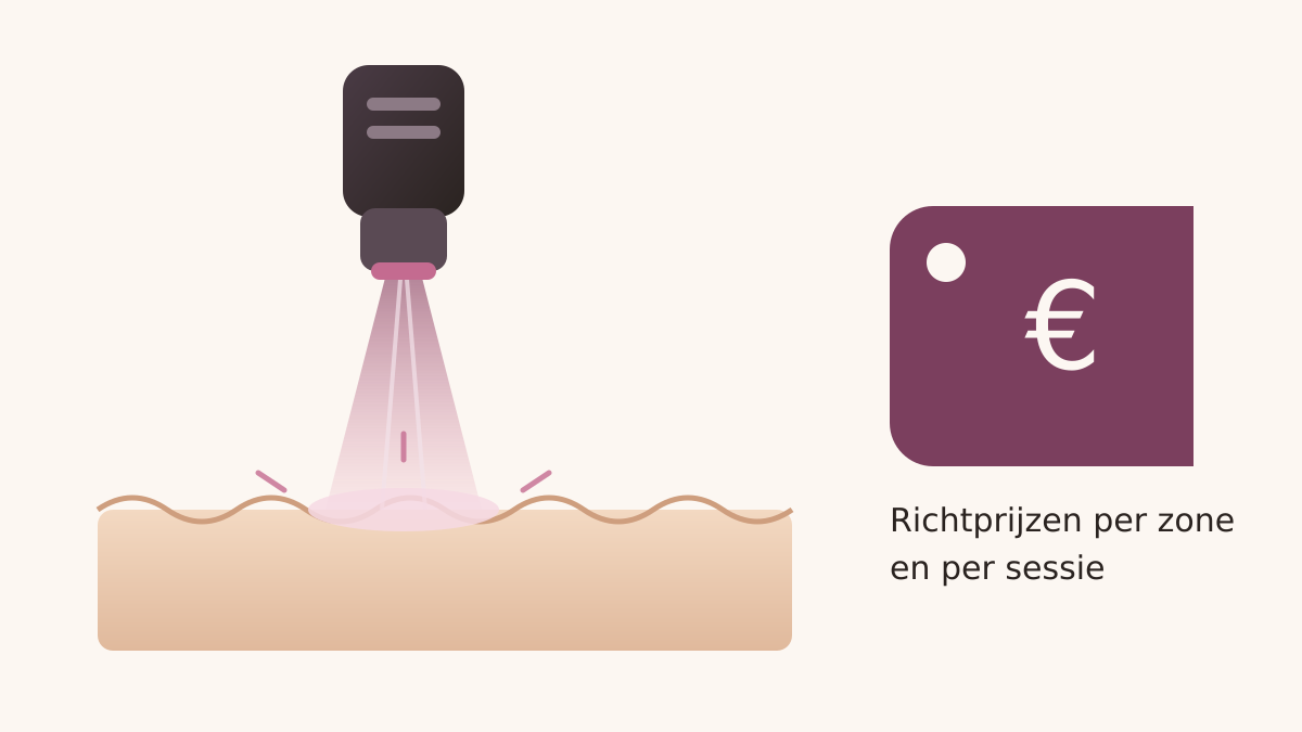Illustratie van een laserbehandeling van de huid met een prijskaartje
